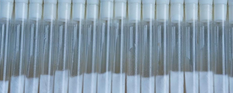 短期保存菌种的方法