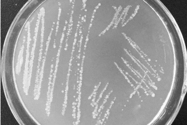 甘油菌菌种活化步骤，甘油菌怎么保存