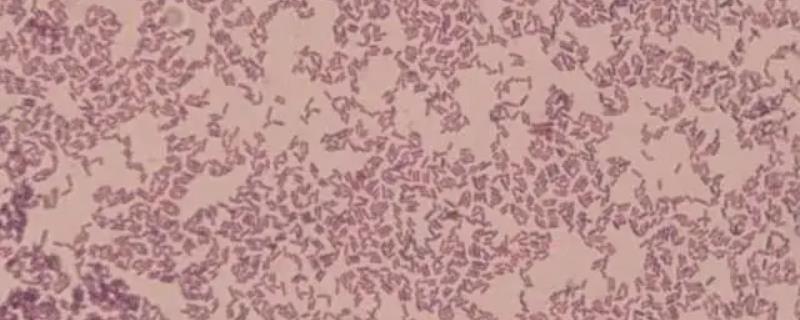 水产养殖em菌的作用与用途，em菌是厌氧菌还是好氧菌