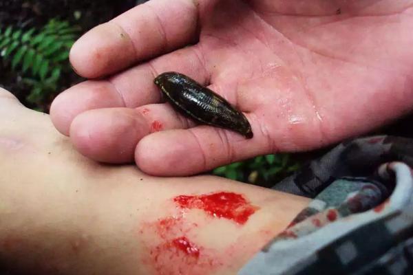 蚂蟥什么地方最多，蚂蟥咬人怎么办